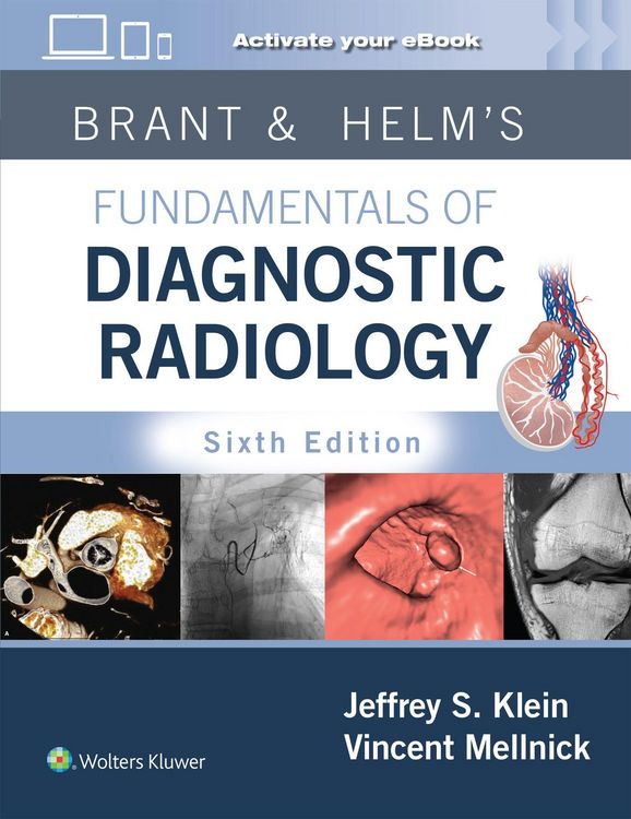 Produktbild: Brant & Helms' Fundamentals of Diagnostic Radiology: Print + eBook with Multimedia