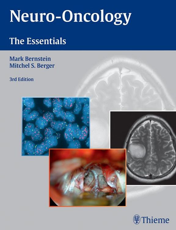 Produktbild: Neuro-Oncology: The Essentials