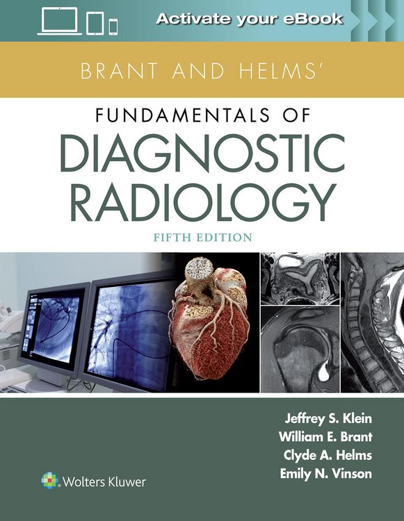 Produktbild: Klein, J: Brant and Helms' Fundamentals of Diagnostic Radiol