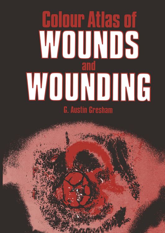 Produktbild: Colour Atlas of Wounds and Wounding