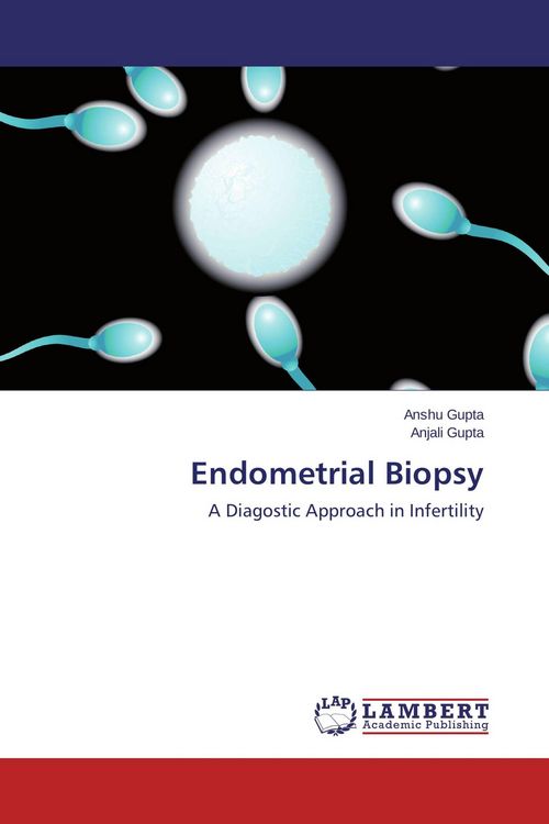Produktbild: Endometrial Biopsy