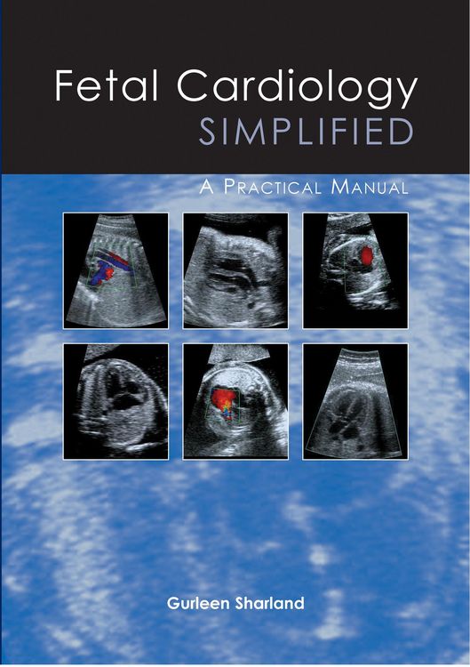 Produktbild: Fetal Cardiology Simplified