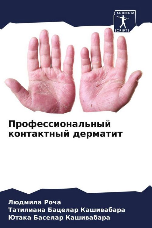 Produktbild: Professional'nyj kontaktnyj dermatit