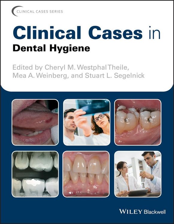Produktbild: Clinical Cases in Dental Hygiene