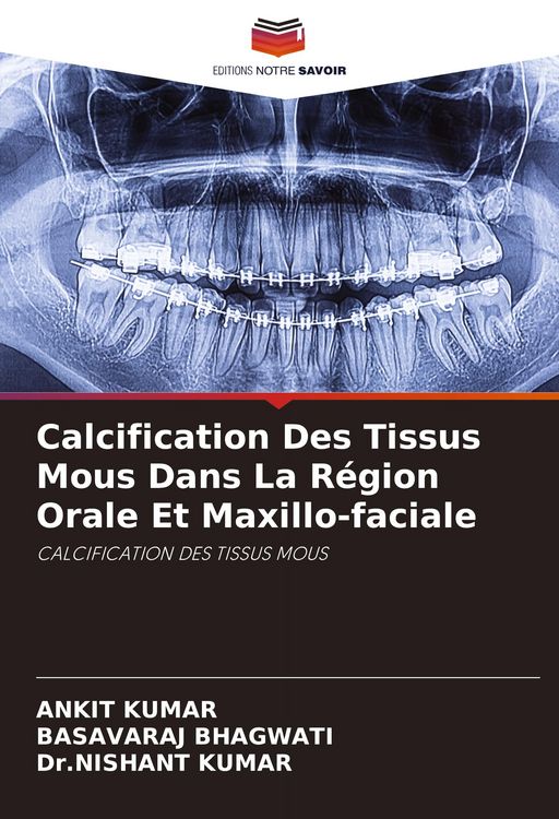 Produktbild: Calcification Des Tissus Mous Dans La R&eacute;gion Orale Et Maxillo-faciale