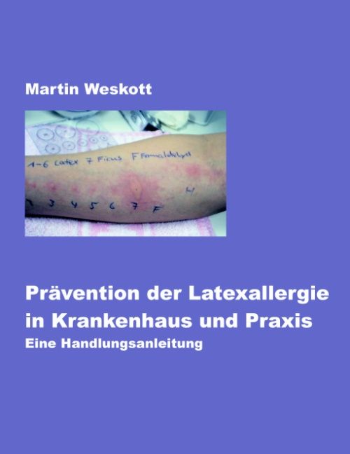 Produktbild: Pr&auml;vention der Latexallergie in Krankenhaus und Praxis