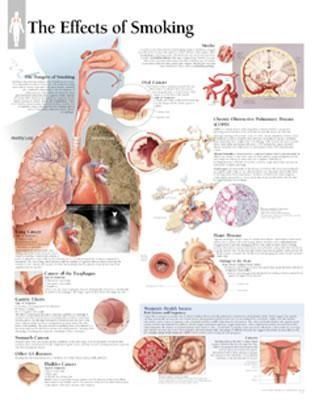 Produktbild: Effects Of Smoking Chart
