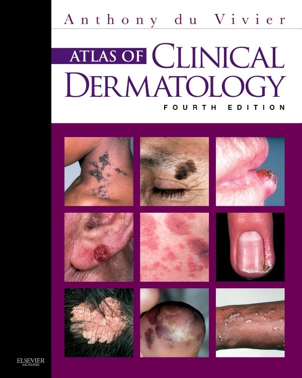 Produktbild: Atlas of Clinical Dermatology