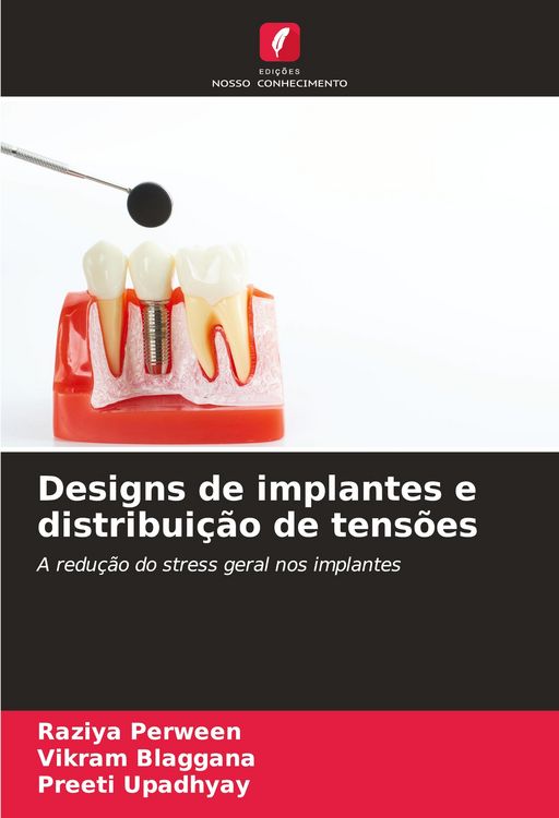 Produktbild: Designs de implantes e distribui&ccedil;&atilde;o de tens&otilde;es