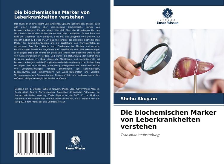Produktbild: Die biochemischen Marker von Leberkrankheiten verstehen