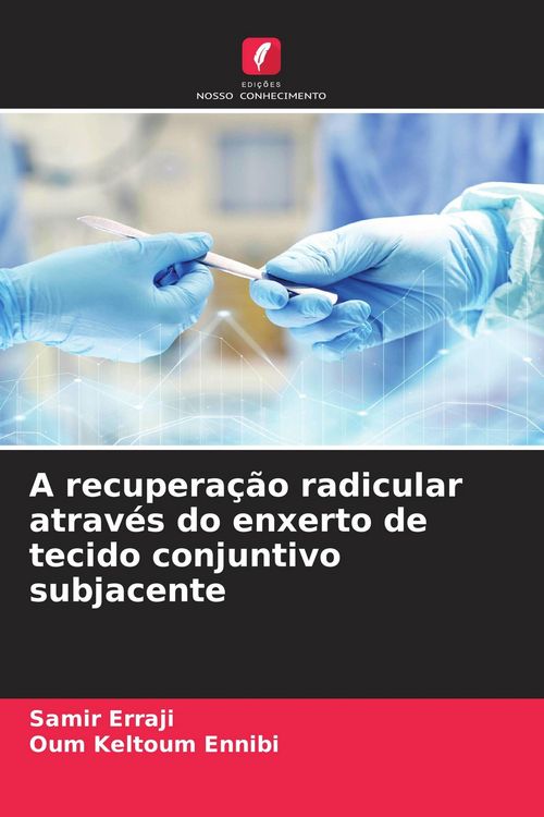 Produktbild: A recupera&ccedil;&atilde;o radicular atrav&eacute;s do enxerto de tecido conjuntivo subjacente