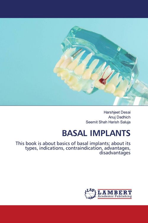 Produktbild: Basal Implants