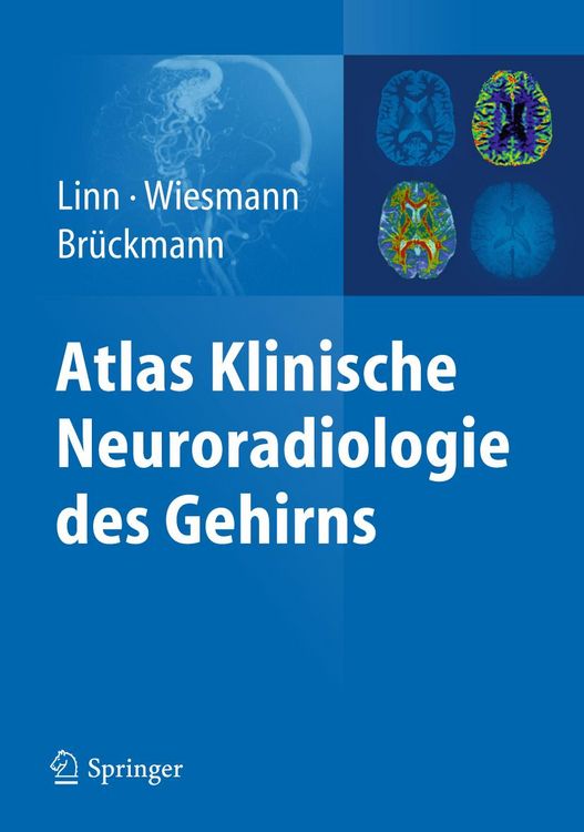 Produktbild: Atlas Klinische Neuroradiologie des Gehirns