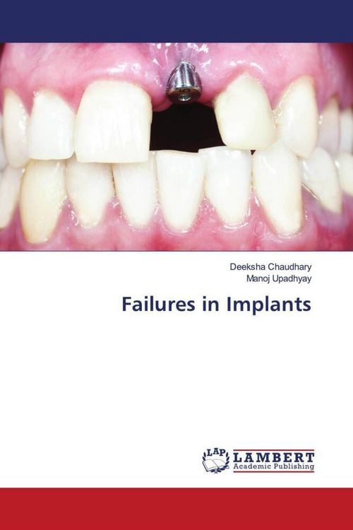 Produktbild: Failures in Implants