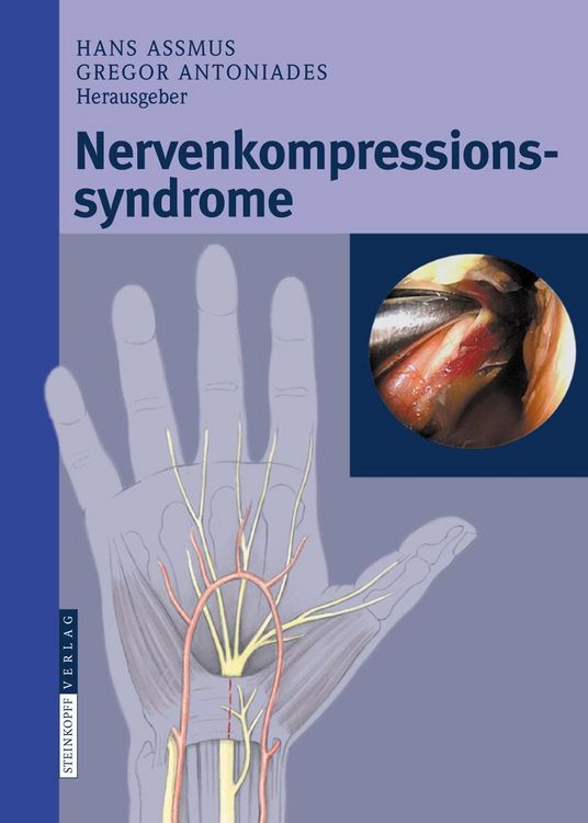 Produktbild: Nervenkompressionssyndrome