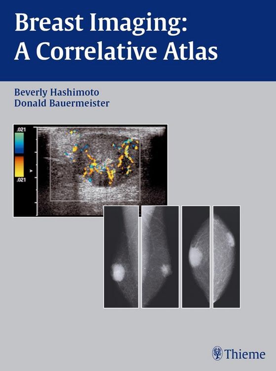 Produktbild: Breast Imaging