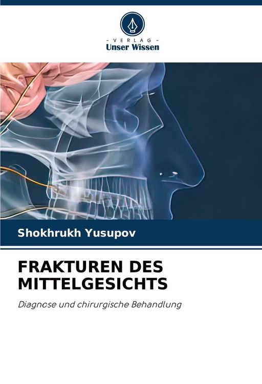 Produktbild: Frakturen des Mittelgesichts