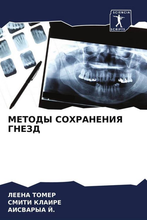 Produktbild: METODY SOHRANENIYa GNEZD