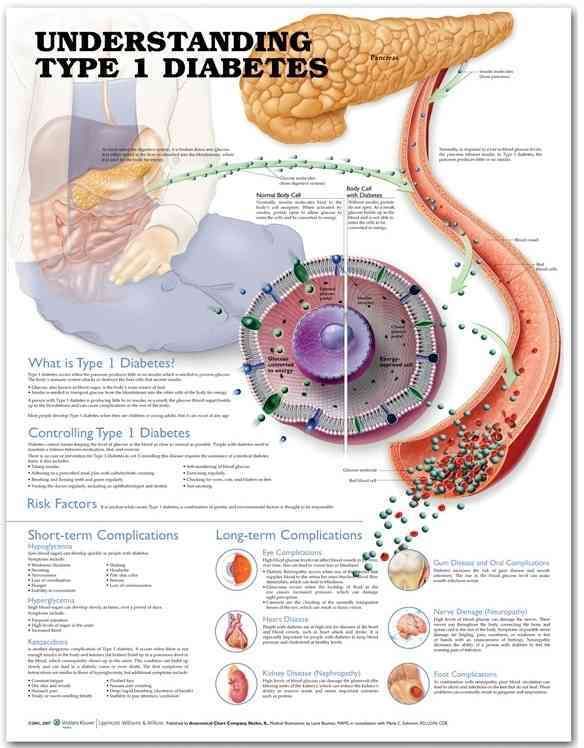 Produktbild: Understanding Type 1 Diabetes