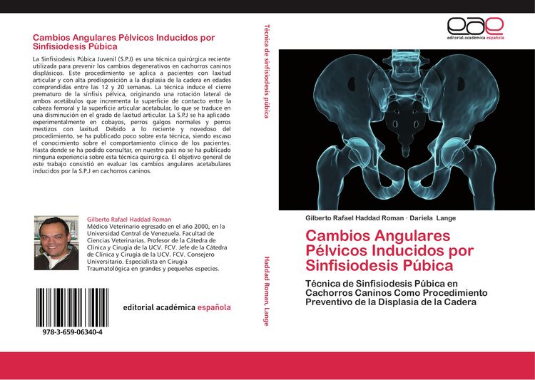 Produktbild: Cambios Angulares P&eacute;lvicos Inducidos por Sinfisiodesis P&uacute;bica