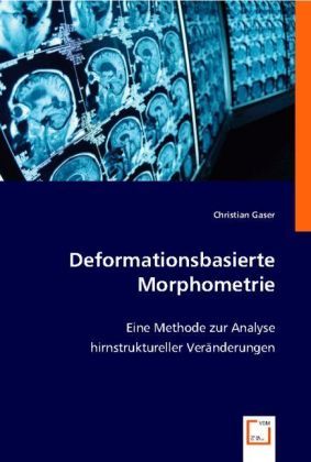Produktbild: Gaser, C: Deformationsbasierte Morphometrie