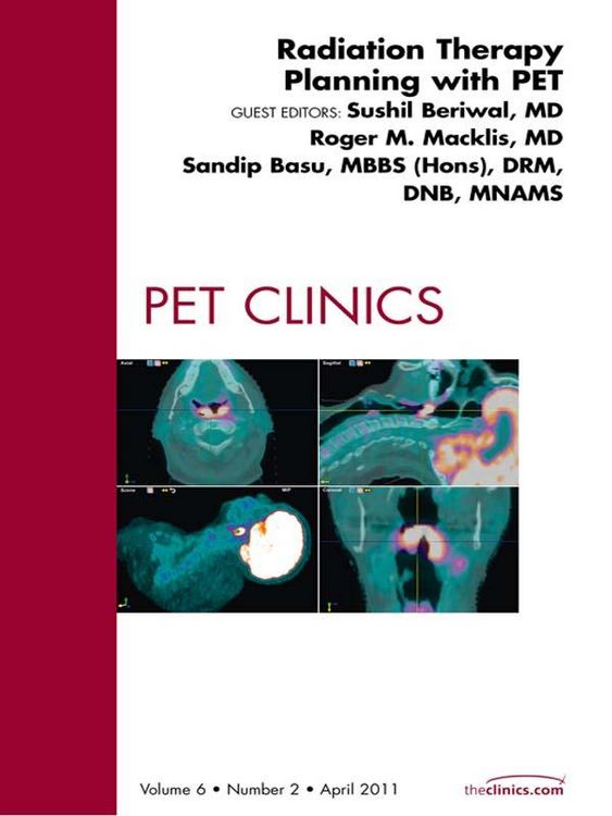 Produktbild: Radiation Therapy Planning, An Issue of PET Clinics