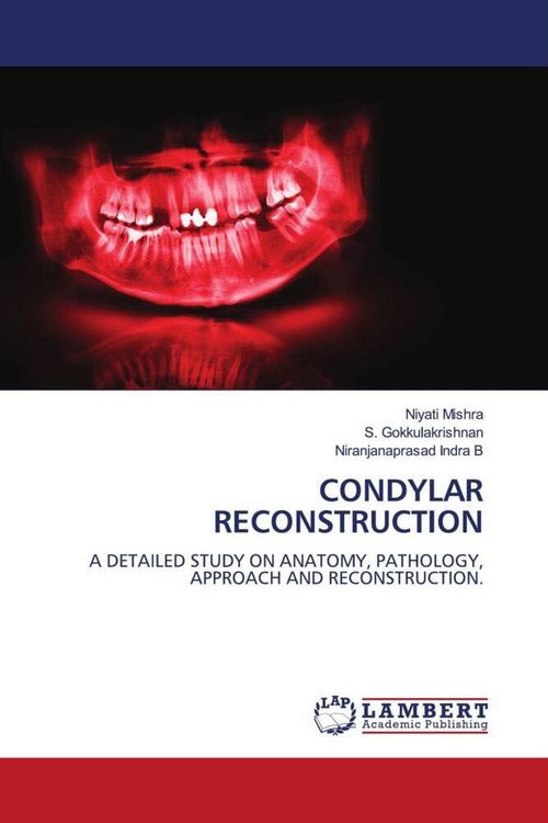 Produktbild: Condylar Reconstruction