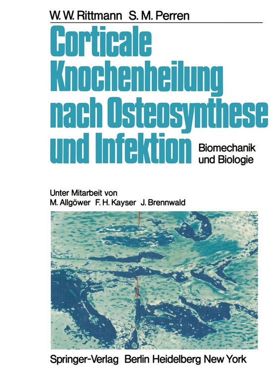 Produktbild: Corticale Knochenheilung nach Osteosynthese und Infektion