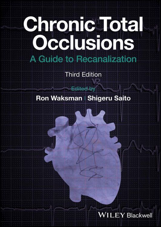 Produktbild: Chronic Total Occlusions