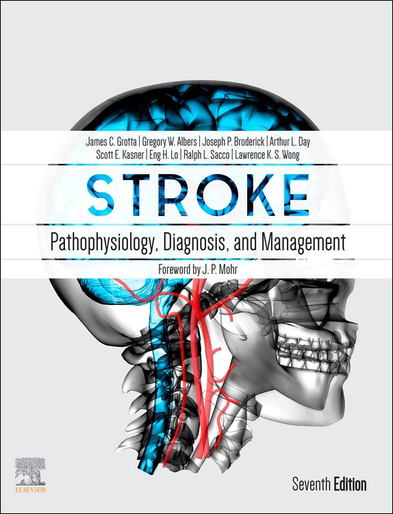 Produktbild: Stroke E-Book