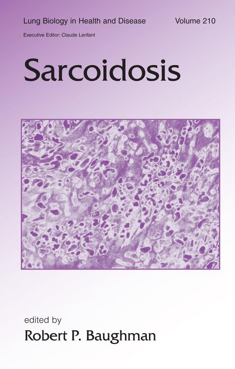 Produktbild: Sarcoidosis