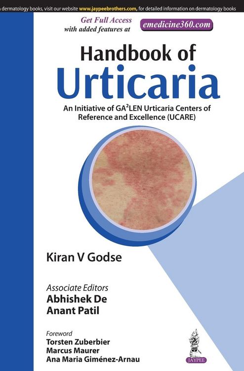 Produktbild: Handbook of Urticaria