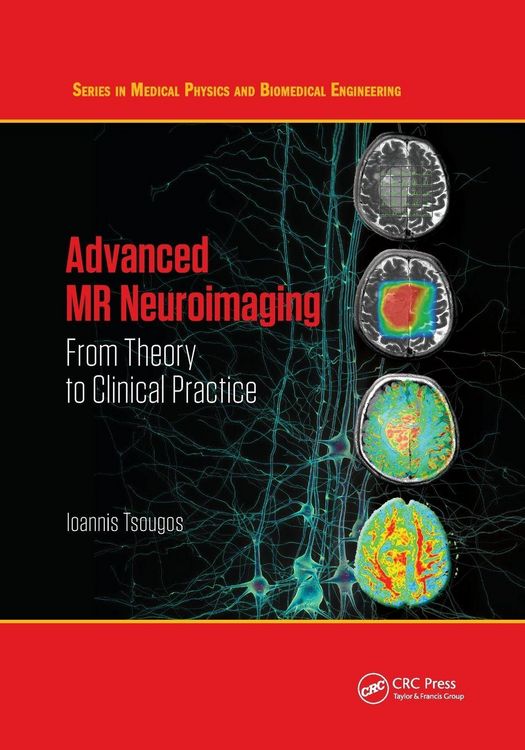 Produktbild: Advanced MR Neuroimaging