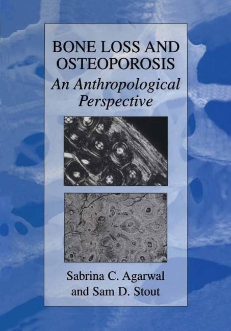 Produktbild: Bone Loss and Osteoporosis