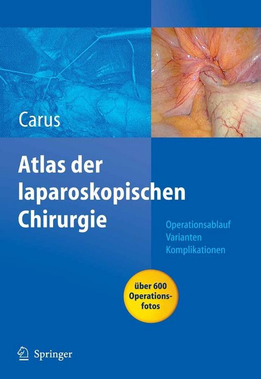 Produktbild: Operationsatlas Laparoskopische Chirurgie