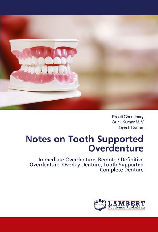 Produktbild: Notes on Tooth Supported Overdenture