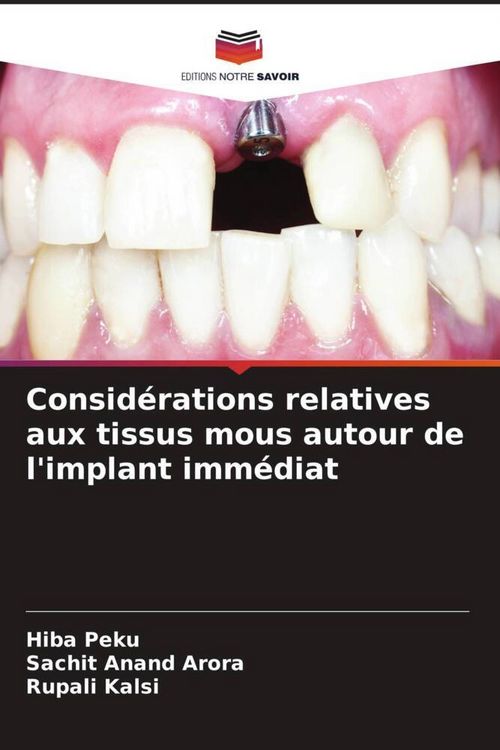 Produktbild: Consid&eacute;rations relatives aux tissus mous autour de l'implant imm&eacute;diat