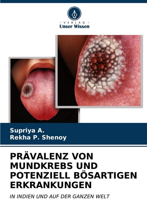 Produktbild: Pr&auml;valenz von Mundkrebs und Potenziell B&ouml;sartigen Erkrankungen
