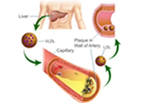 Produktbild: Estimation of Blood LDL Cholesterol and VLDL Cholesterol