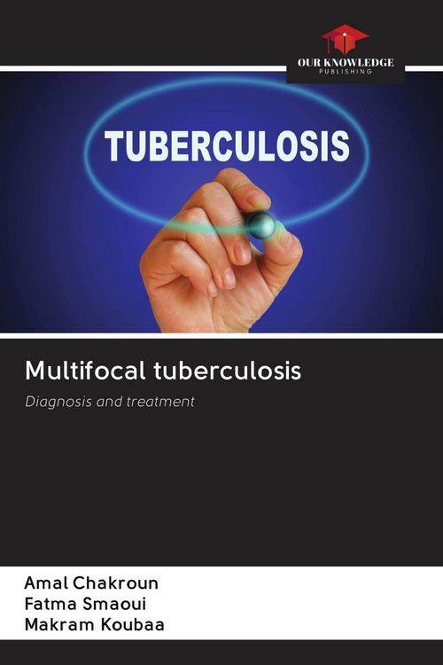 Produktbild: Multifocal tuberculosis