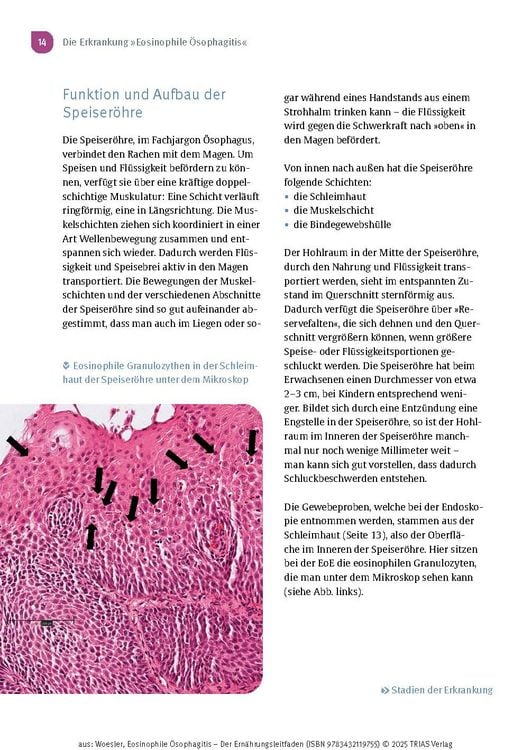 Produktbild: Eosinophile &Ouml;sophagitis - Der Ern&auml;hrungsleitfaden