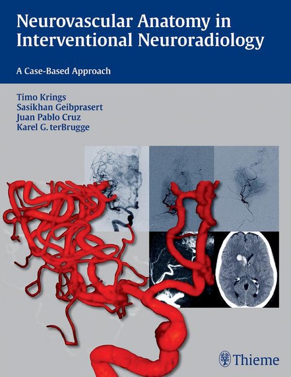 Produktbild: Neurovascular Anatomy in Interventional Neuroradiology