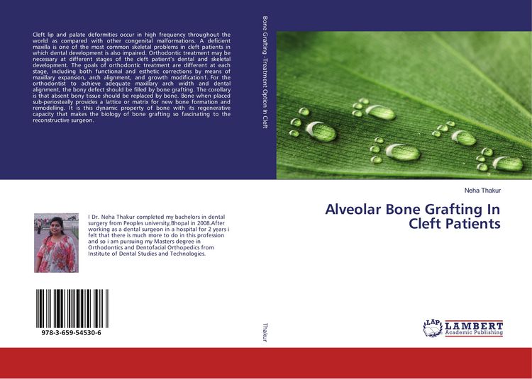 Produktbild: Alveolar Bone Grafting In Cleft Patients