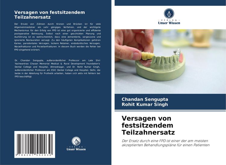 Produktbild: Versagen von festsitzendem Teilzahnersatz