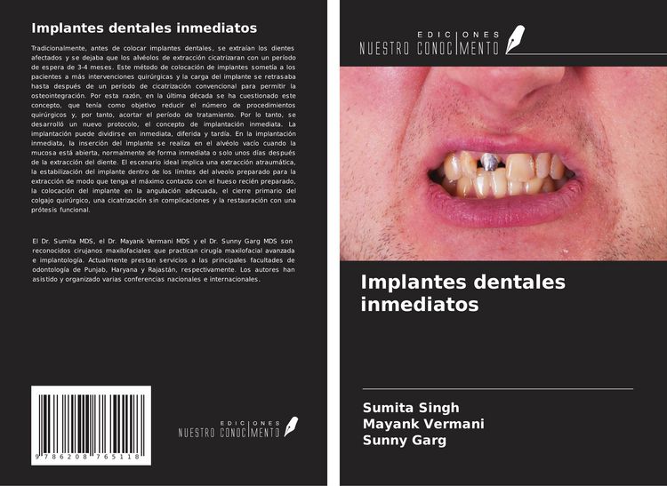 Produktbild: Implantes dentales inmediatos