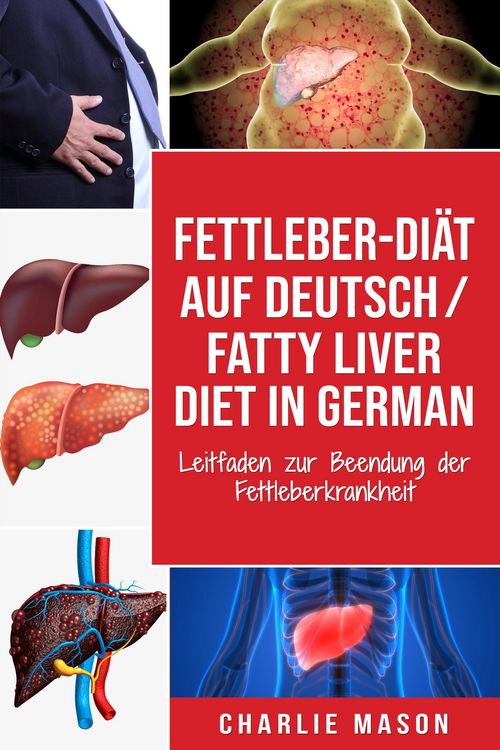 Produktbild: Fettleber-Di&auml;t Auf Deutsch/ Fatty liver diet In German: Leitfaden zur Beendung der Fettleberkrankheit