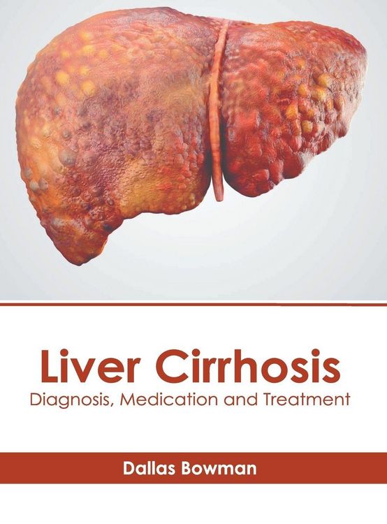 Produktbild: Liver Cirrhosis: Diagnosis, Medication and Treatment