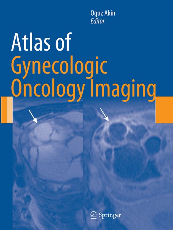 Produktbild: Atlas of Gynecologic Oncology Imaging