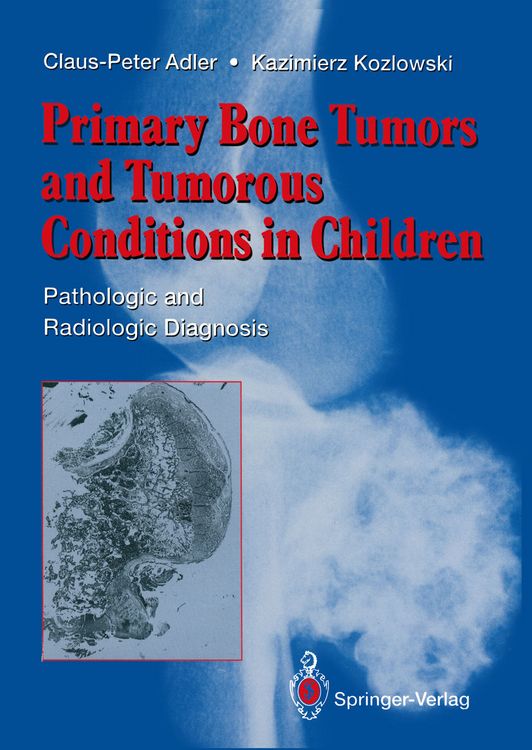 Produktbild: Primary Bone Tumors and Tumorous Conditions in Children