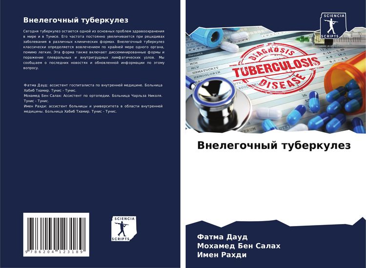 Produktbild: Vnelegochnyj tuberkulez